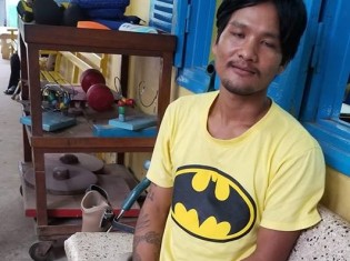 カンボジア・シェムリアップにあるフィジカル・リハビリテーション・センターで義足を取り換えに来ていたマー・シチャンさん。2番目の子どもとなる女児が最近生まれたと嬉しそうだ