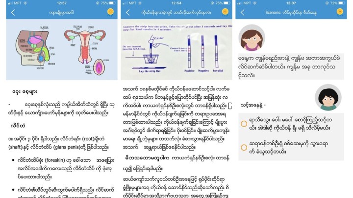 ミャンマー保健省は、国連人口基金（UNFPA）と協力し、スマホ用アプリ「Love question Life answer」を開発した。写真はその画面を撮ったもの。性に関する用語解説や避妊具の説明などのほか、性の悩みを相談できるホットラインもある